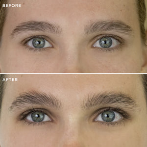Multi-Peptide Growth Serum